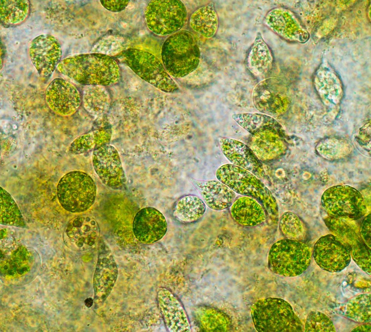 microscopic picture of green Eukaryotes
