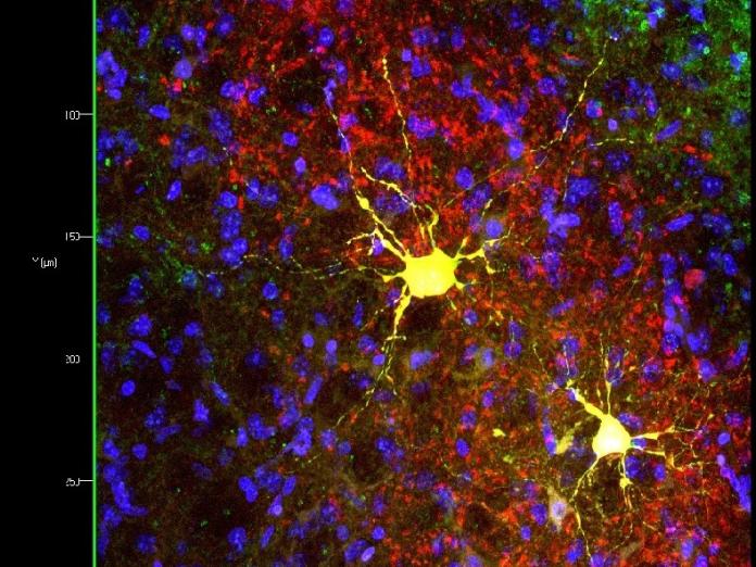 confocal image of neurons